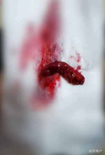 谁有亲身的药物流产的经历?