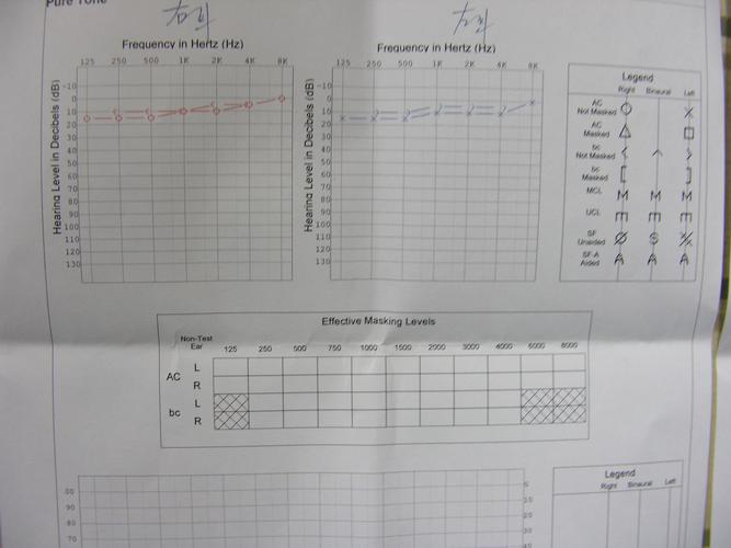 我的听力有问题吗?(附听力检查报告)