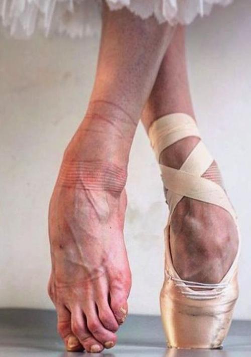 一绷遮百丑就是我没有总有一双漂亮的芭蕾脚叫别人的