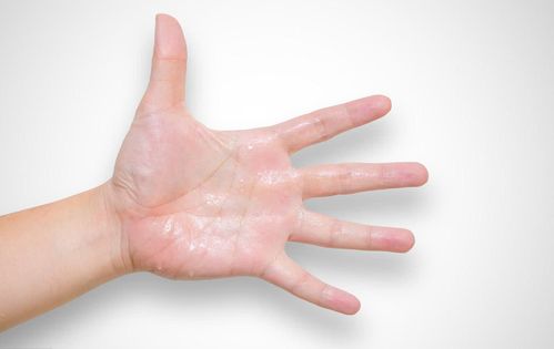 出汗多也是病!中医:夏天别做这件短命事!内附调理方法