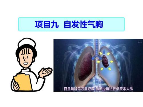 自发性气胸ppt课件