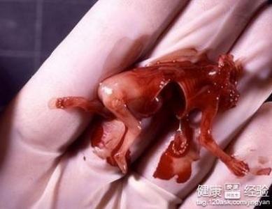 最真实的经验分享_健康经验_快速问医生