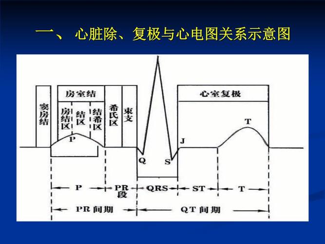 心电图基本知识解决方案.ppt