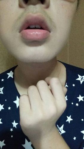 下巴为什么会有一条线,我的下巴骨中间凹进去的,瘦了下巴可以变平吗?