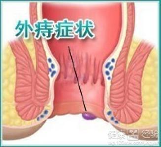 肛肠疾病我感觉肛门周围有点小凸如何治疗