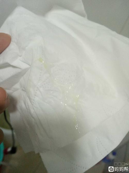 老是有这样的分泌物正常么