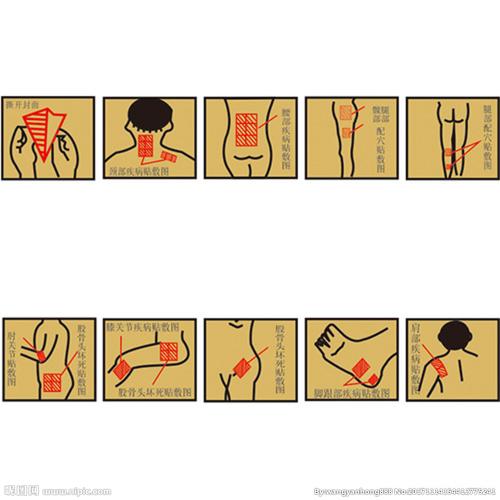 贴敷示意图图片