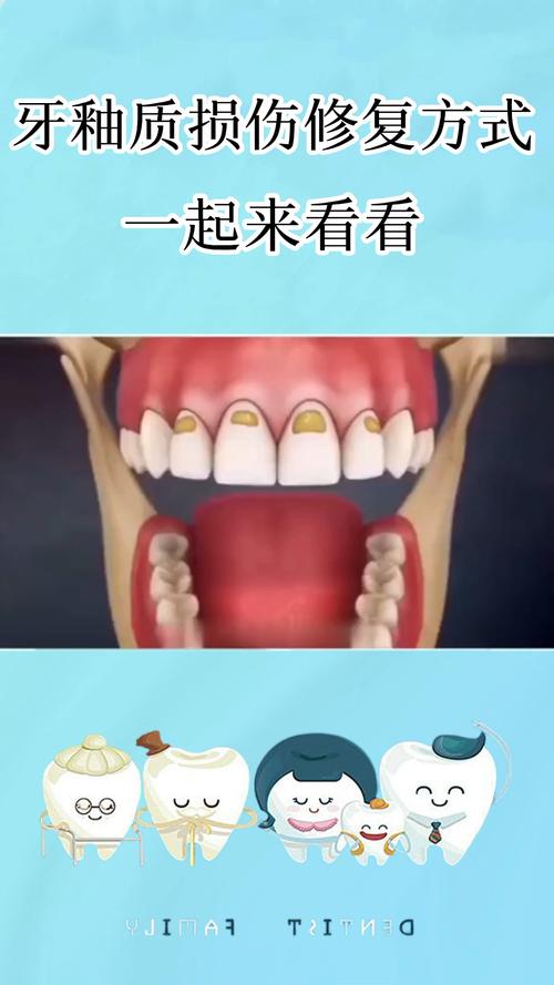 损伤了牙釉质该怎么修复呢?_口腔健康_口腔_医疗健康_医疗健康其他