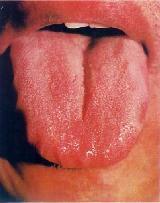 教你舌诊 一看就明白