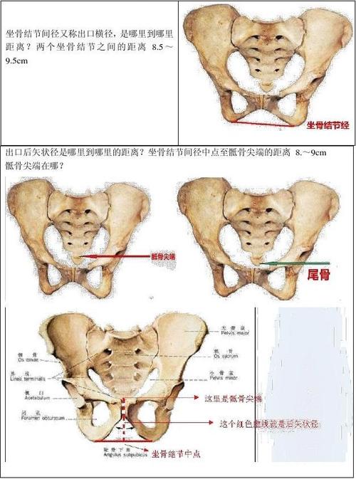 骨盆测量一看就懂