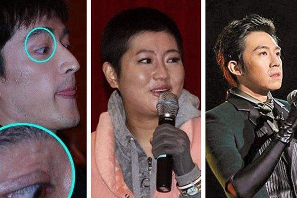 selina和老公离婚原因是什么呢全身烧伤程度照片是怎样