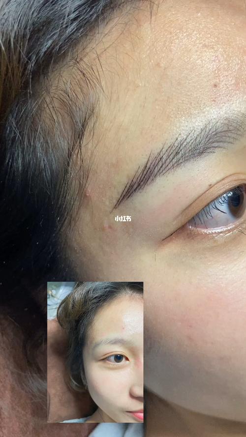 纹眉_纹眉_野生眉_美妆_医美整形