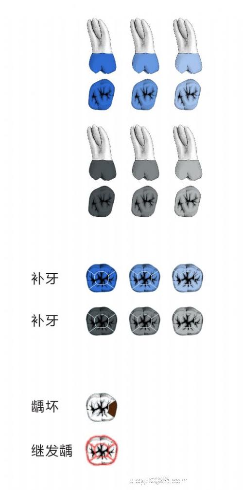 "皇冠上的明珠"---金牌洽谈ipad智能牙位图