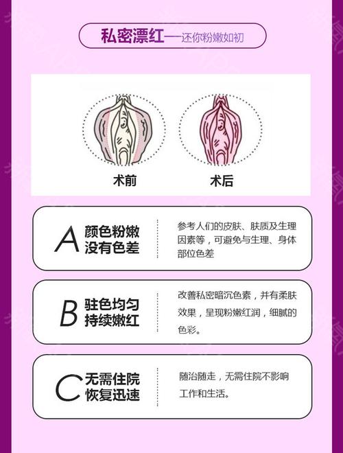 【66返场狂欢】【私密漂红】【私密粉嫩回春术】小阴唇/大阴唇粉嫩漂