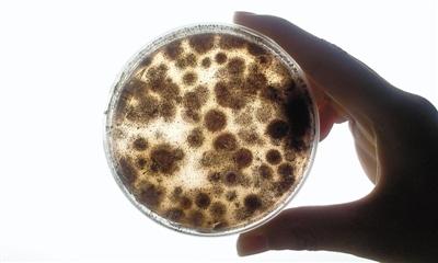 实验4中,散热片清洗前的样本,霉菌培养皿中长出大片霉. .