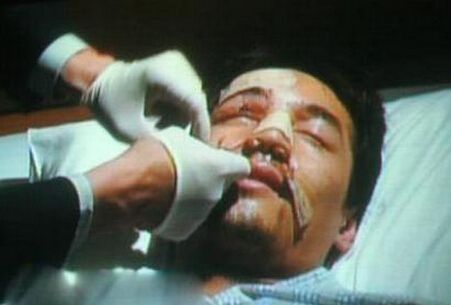 胡歌车祸前后照片对比 揭秘胡歌车祸诡异内幕(5)