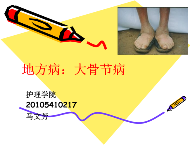 地方病:自大骨节病.ppt