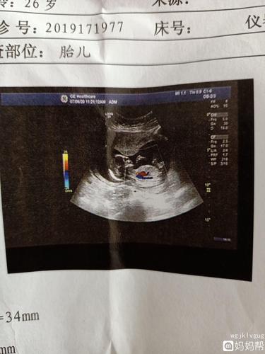 宝宝十六周了越来越好奇是男孩女孩因为