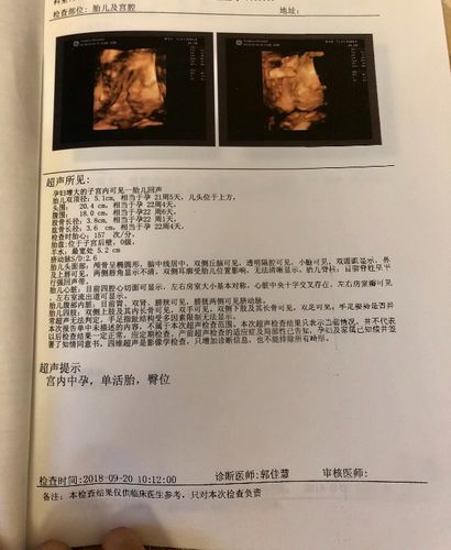 24周做的四维,能帮我看一下宝宝正常吗?