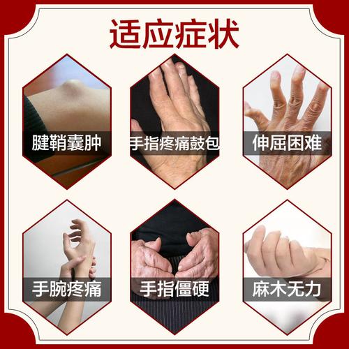 腱鞘涂抹膏大拇指腱鞘炎腱鞘囊肿舒筋贴手腕鼓包关节肿大突出膏药