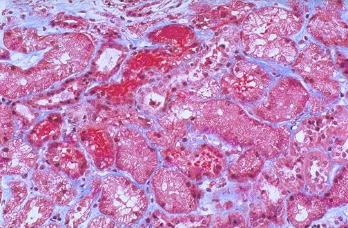 href="/item/红细胞">红细胞 /a>破坏加速或生成减少而致外周血红细胞