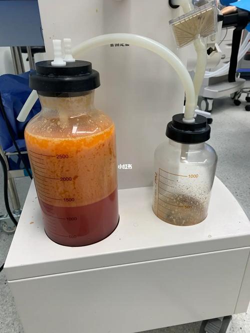 两条腿抽了三千左右的纯脂肪_塑身裤_减肥_减肥医药