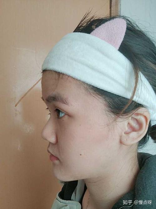 翘下巴月亮脸鞋拔子脸是不是很丑