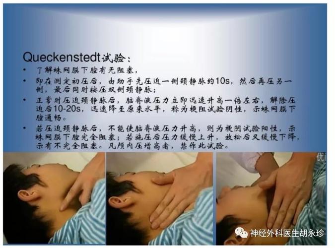 腰椎穿刺术,我们为什么要做?