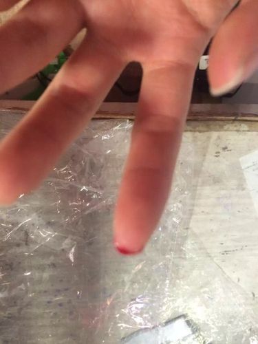 手又戳破了,呵呵!