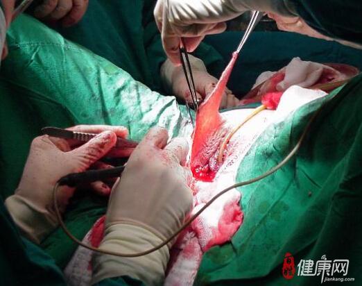 为未成年少年摘除睾丸变性 实习医生被批捕