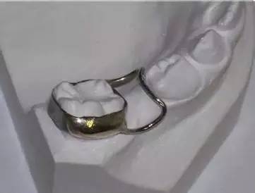 乳恒牙替换时应注意的问题