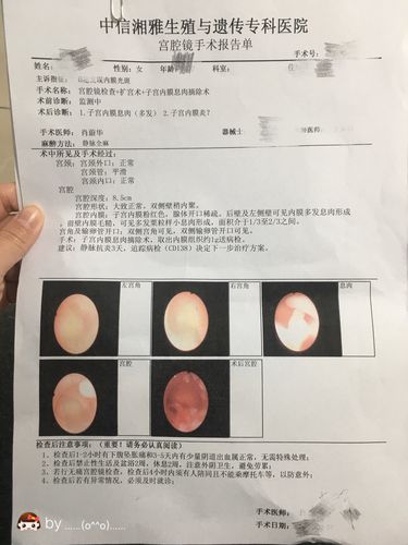 这是我做宫腔镜检查的报告.这是显示子宫内膜有炎症吗?