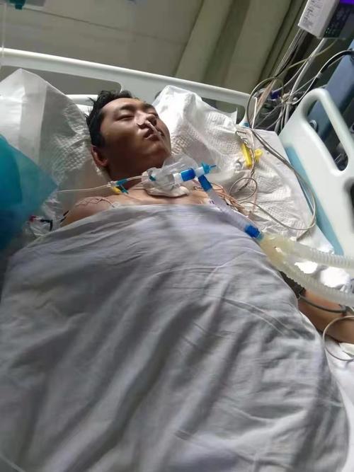 23岁优秀体育生即将毕业不慎摔成重伤icu昏迷一月之久急需援助