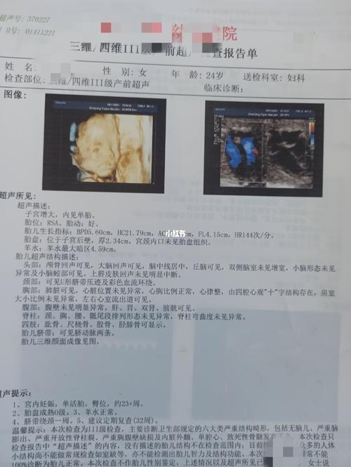 四维彩超检查请大家帮忙看看是男孩还是女孩_四维彩超