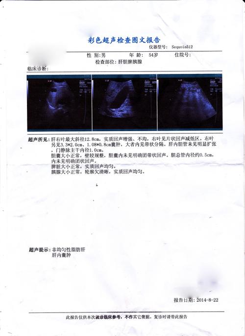 肝囊肿 和 甘油三酯 高