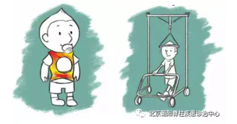 其他保守治疗的方法(左:石膏背心;右:牵引)