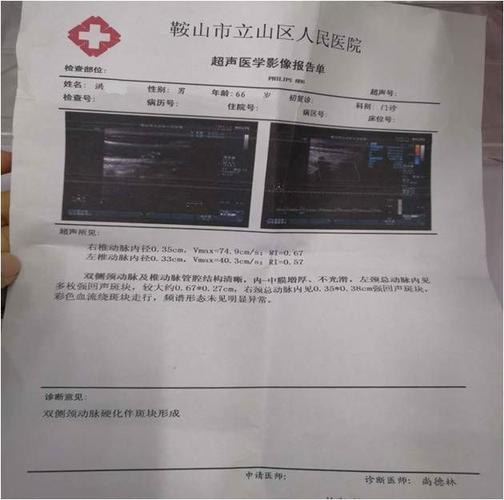试用后,颈动脉彩超报告单