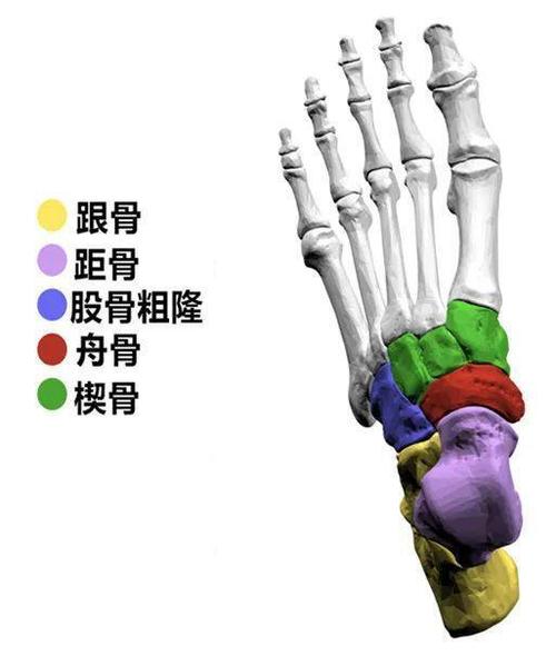 足副舟骨(即足舟骨之子骨)是舟状骨结节部第二化骨中心的先天性变异.