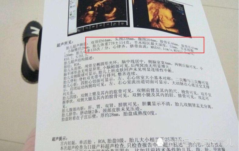 女孩四维彩超图及数据根据四维彩超的数据怎么区分男孩女孩