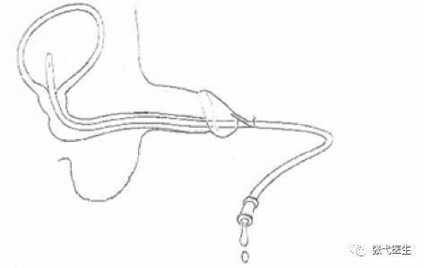小鸡鸡问题尿道下裂该怎么修复