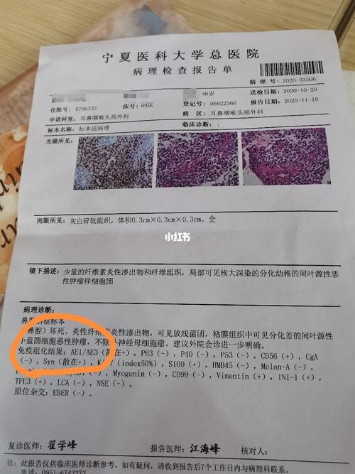 确诊了是小蓝圆细胞恶性肿瘤,不是鼻咽癌,现在要和我妈往北京转院去