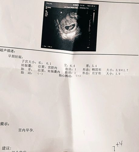 哪位小仙女懂彩超啊 这是怀孕多久了