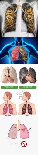 下面的图片是要小朋友们了解一下正常人的肺和吸了烟的肺.