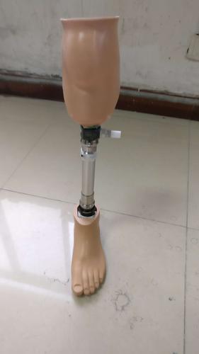 杨轶给疑难患者制作假肢过程