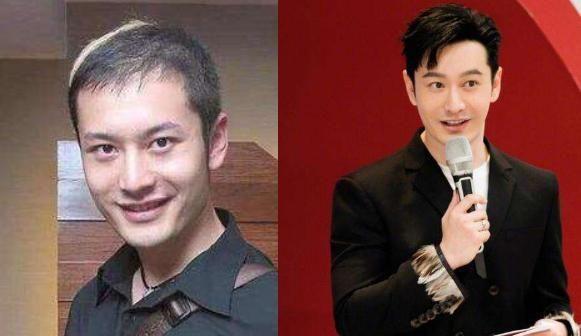 黄晓明确实存在英年早秃的情况,其实在娱乐圈当中,男明星出现这种状况