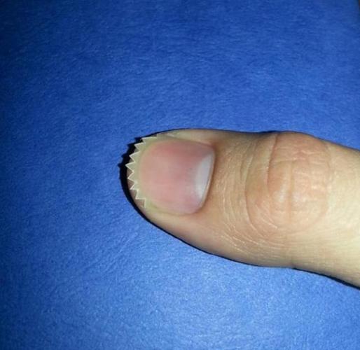 把指甲剪成锯齿状,挠人