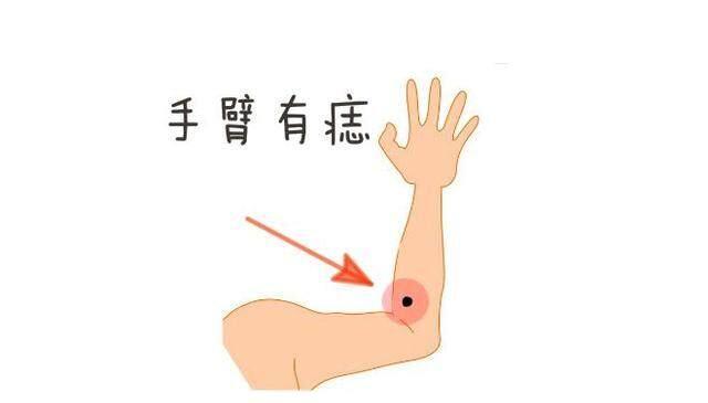 身体这五处有痣一生财运如虹注定大富大贵好运连连