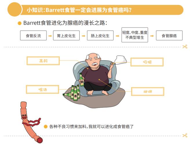该进程大致为:食管反流→上皮化生→不典型增生→食管 barrett(巴雷特