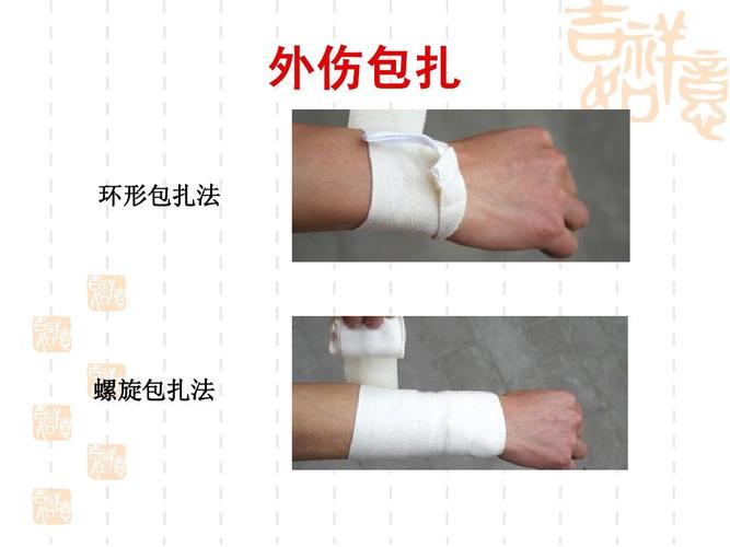 外伤包扎 环形包扎法 螺旋包扎法