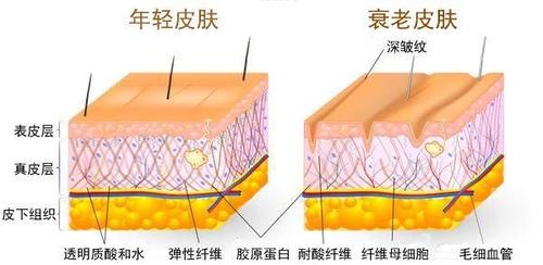 皮肤为什么会衰老,都有哪些表现?_皱纹